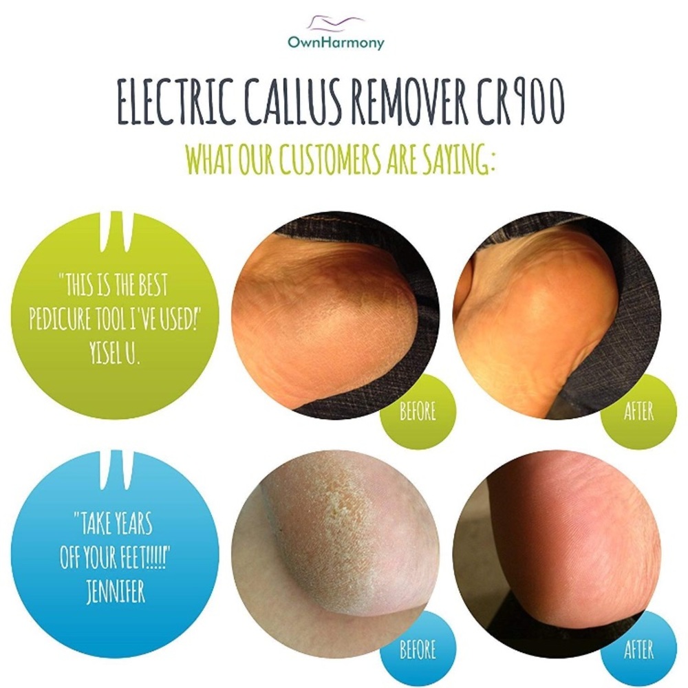 Electric Foot Callus Remover Rechargeable - Picture 2 of 6
